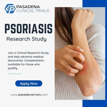 Earn Money for Paid Participation in a Psoriasis Clinical Study in Pasadenas