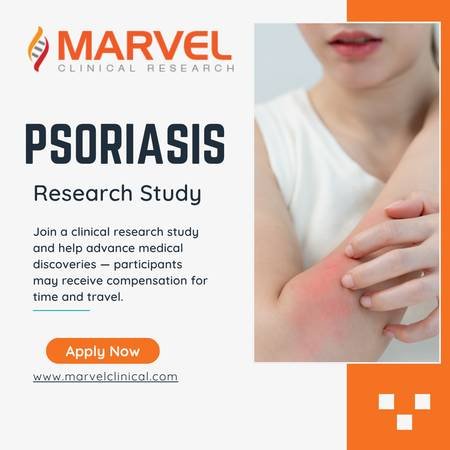 Earn Money for Paid Participation in a Psoriasis Clinical Study in Huntington Beachs
