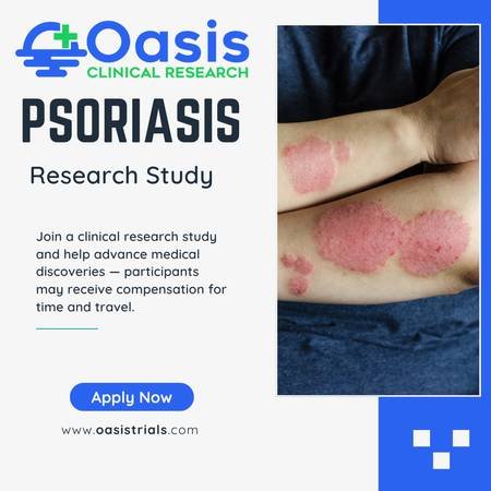 Join Our Plaque Psoriasis Study at Oasis Clinical Research in Las Vegass